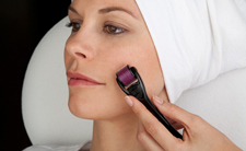 Eliminar cicatrizes de acne
