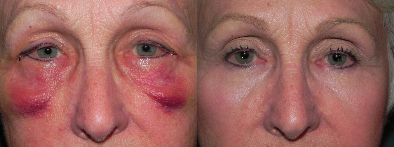 Conheça os benefícios da drenagem linfática - Esteticista Como Você