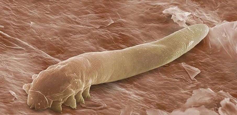 Demodex folliculorum