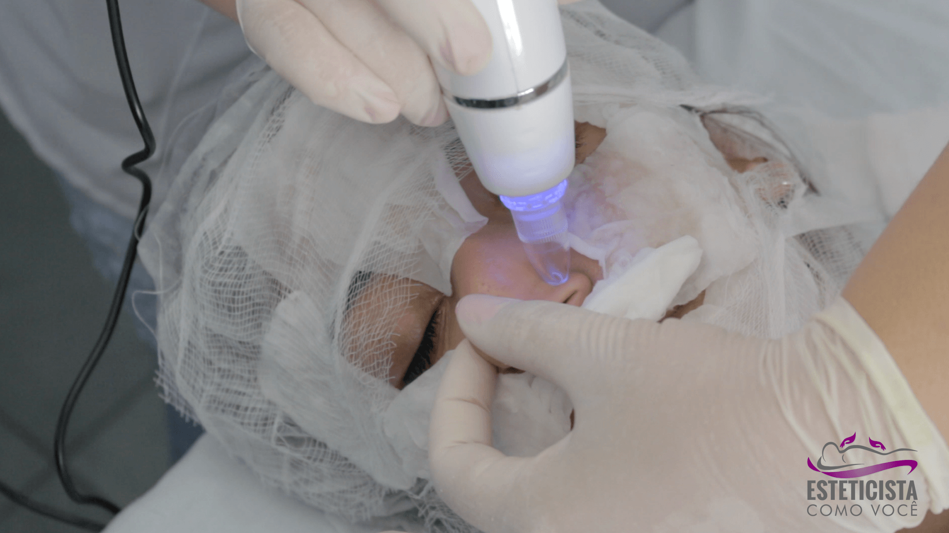 Peeling de Diamante