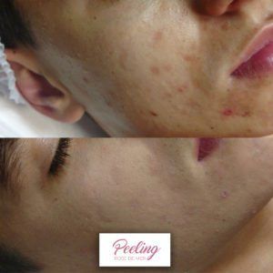 Antes-e-Depois-1-300x300