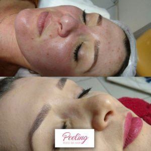 Antes-e-Depois-3-300x300
