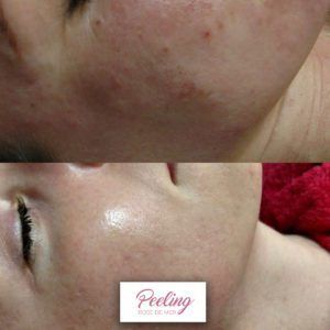 Antes-e-Depois-4-300x300