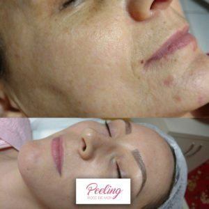 Antes-e-Depois-5-300x300