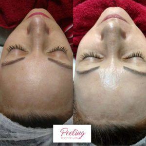Antes-e-Depois-6-300x300