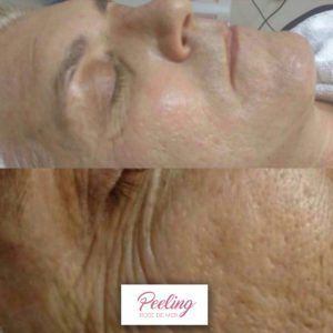 Antes-e-Depois-7-300x300