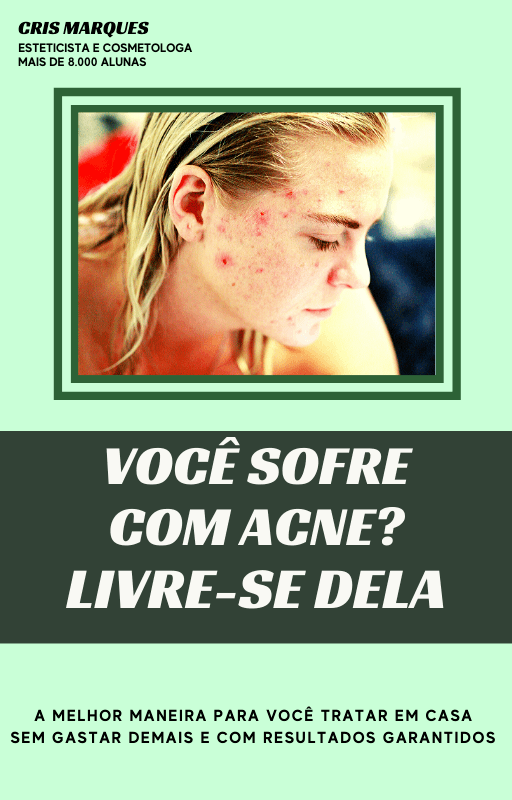 Capa e-Book ACNE